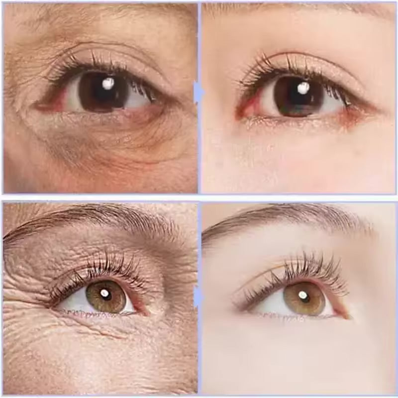 Instant Eye Cream For Anti Aging Dark Circles Bags